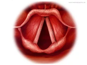 Bild: Akute Laryngitis