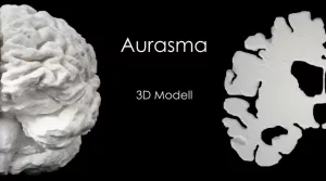 Video: 3D Modell eines Gehirns mit Überlagerung aus Aurasma