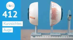 Video: Kurzsichtes Auge