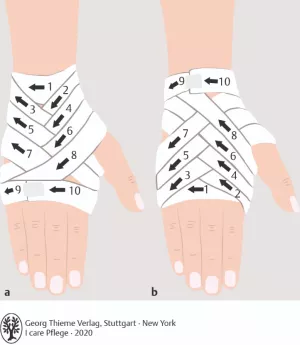 Bild: I care Pflege | Pflegetechniken | Kornährenverband (Grafik)
