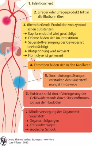 Bild: I care Pflege | Pflege bei speziellen Erkrankungen | Verlauf der Sepsis (Grafik)