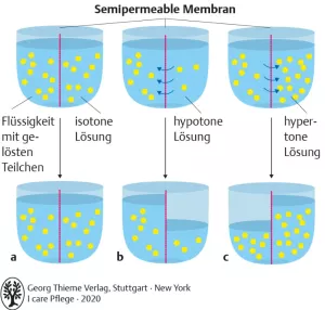 Bild: I care Pflege | Pflegetechniken | Osmose und Osmolarität (Grafik)