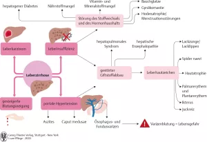 Bild: I care Pflege | Pflege bei speziellen Erkrankungen | Leberzirrhose (Grafik)