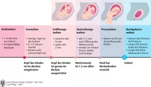 Bild: I care Pflege | Unterschiedliche Pflegesettings | Geburtsverlauf (Grafik)