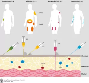 Bild: I care Pflege | Pflegetechniken | Injektionsarten und deren Injektionsbereiche, Injektionstiefen und Injektionswinkel (Grafik)