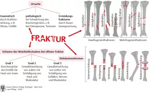 Bild: I care Pflege | Pflege bei speziellen Erkrankungen | Klassifikation von Frakturen (Grafik)