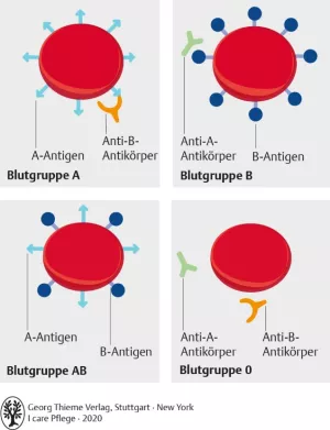 Bild: I care Pflege | Pflegetechniken | AB0-Blutgruppensystem (Grafik)