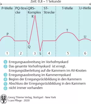 Bild: I care Krankheitslehre | Spezielle Krankheitslehre | Herzzyklus im normalen EKG (Grafik)