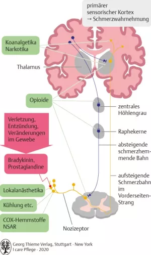 Bild: I care Krankheitslehre | Grundlagen | Schmerzentstehung, Schmerzweiterleitung und Wirkorte verschiedener Analgetika (Grafik)
