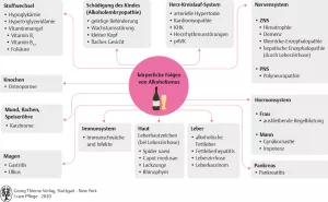 Bild: I care Krankheitslehre | Spezielle Krankheitslehre | Körperliche Folgen des Alkoholismus (Grafik)