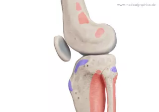 Bild: Knie mit Muskelansätzen (lateral)