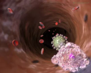 Bild: Blutgefäß mit HI-Virus