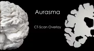 Video: Gehirnmodell mit AR Überlagerung eines CT Scan