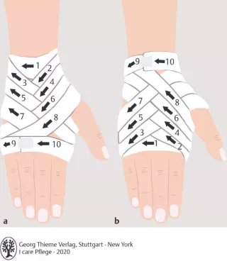 Bild: I care Pflege | Pflegetechniken | Kornährenverband (Grafik)