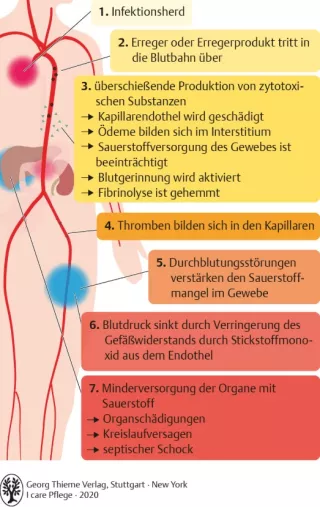 Bild: I care Pflege | Pflege bei speziellen Erkrankungen | Verlauf der Sepsis (Grafik)