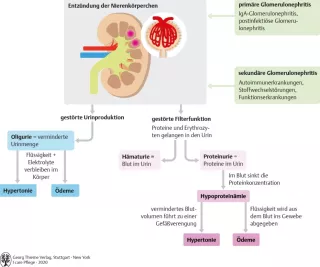 Bild: I care Pflege | Pflege bei speziellen Erkrankungen | Glomerulonephritis (Grafik)