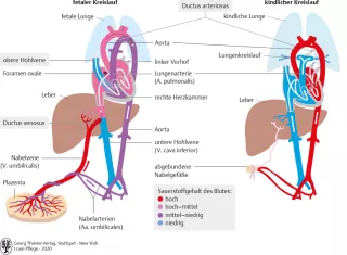 Bild: I care Pflege | Pflege bei speziellen Erkrankungen | Fetaler und kindlicher Kreislauf (Grafik)
