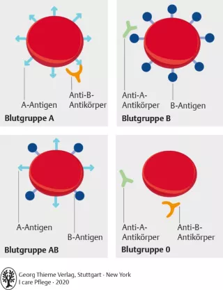 Bild: I care Pflege | Pflegetechniken | AB0-Blutgruppensystem (Grafik)