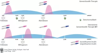 Bild: I care Krankheitslehre | Spezielle Krankheitslehre | Formen der Insulintherapie (Grafik)