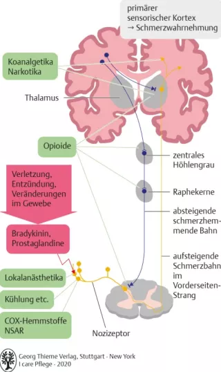 Bild: I care Krankheitslehre | Grundlagen | Schmerzentstehung, Schmerzweiterleitung und Wirkorte verschiedener Analgetika (Grafik)