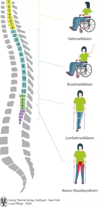 Bild: I care Krankheitslehre | Spezielle Krankheitslehre | Rückentrauma (Grafik)