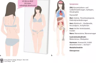 Bild: I care Krankheitslehre | Spezielle Krankheitslehre | Körperschemastörung bei Anorexie (Grafik)
