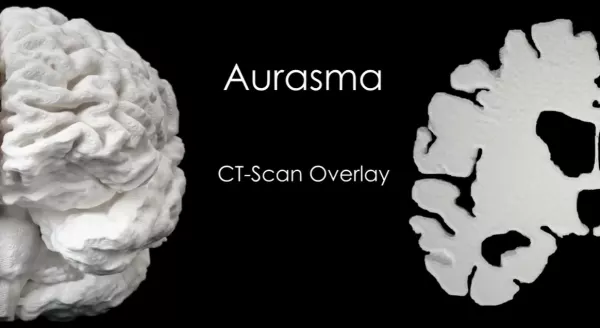 Video: Gehirnmodell mit AR Überlagerung eines CT Scan