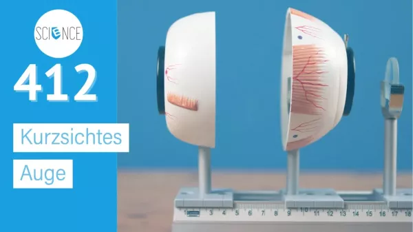Video: Kurzsichtes Auge
