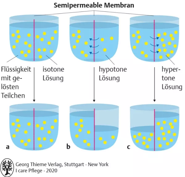 Bild: I care Pflege | Pflegetechniken | Osmose und Osmolarität (Grafik)