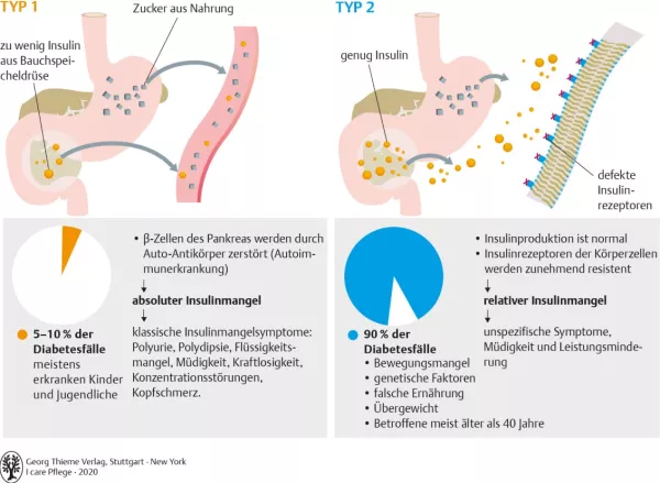 Bild: I care Pflege | Pflege bei speziellen Erkrankungen | Diabetes mellitus (Grafik)