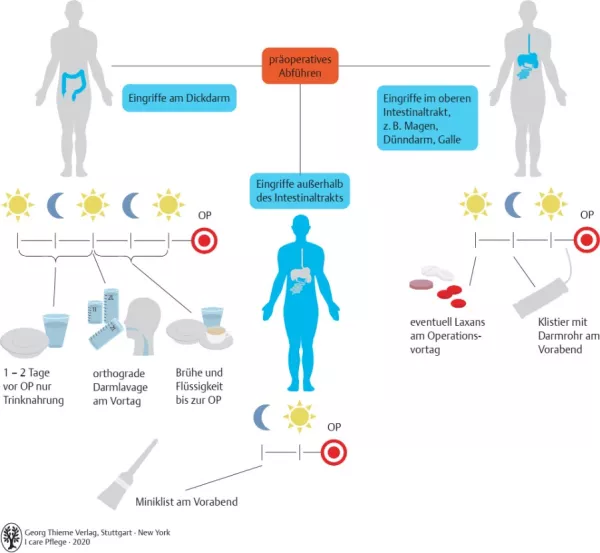 Bild: I care Pflege | Unterschiedliche Pflegesettings | Präoperatives Abführen (Grafik)