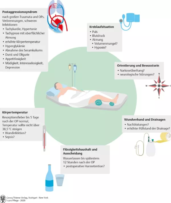 Bild: I care Pflege | Unterschiedliche Pflegesettings | Patientenüberwachung nach einer OP (Grafik)