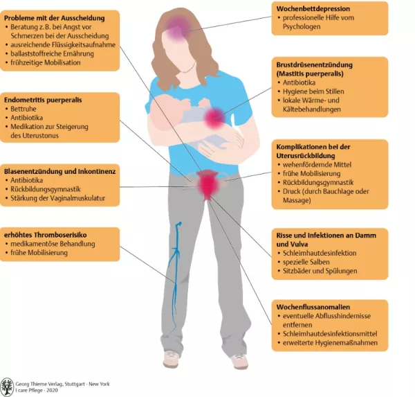 Bild: I care Pflege | Unterschiedliche Pflegesettings | Wochenbett (Grafik)