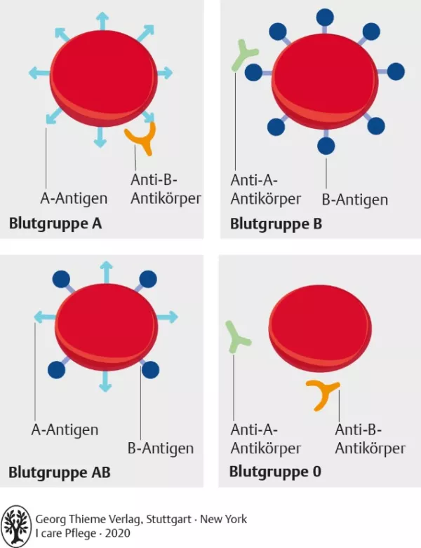 Bild: I care Pflege | Pflegetechniken | AB0-Blutgruppensystem (Grafik)