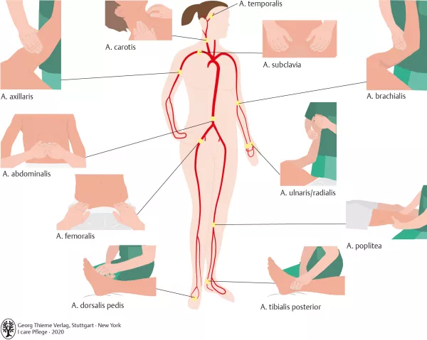 Bild: I care Pflege | Pflegebasismaßnahmen | Pulsmessorte (Grafik)