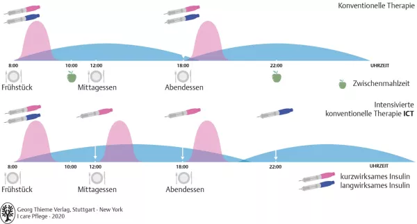 Bild: I care Krankheitslehre | Spezielle Krankheitslehre | Formen der Insulintherapie (Grafik)